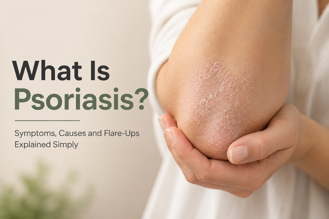What Is Psoriasis? Symptoms, Causes and Flare-Ups Explained Simply