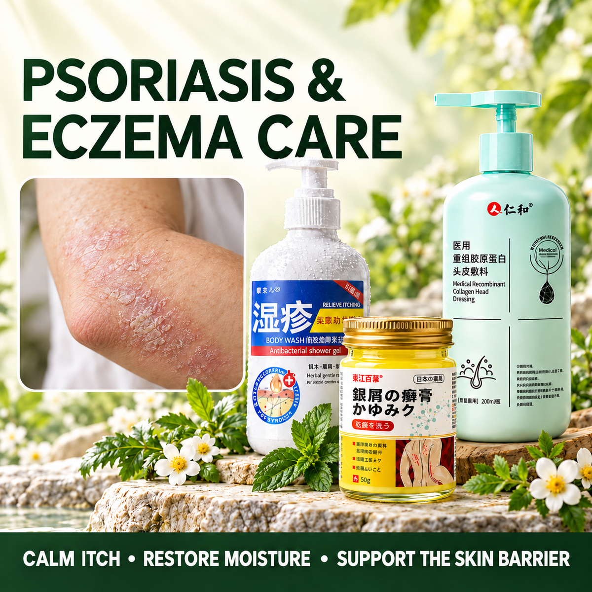 Psoriasis & Eczema