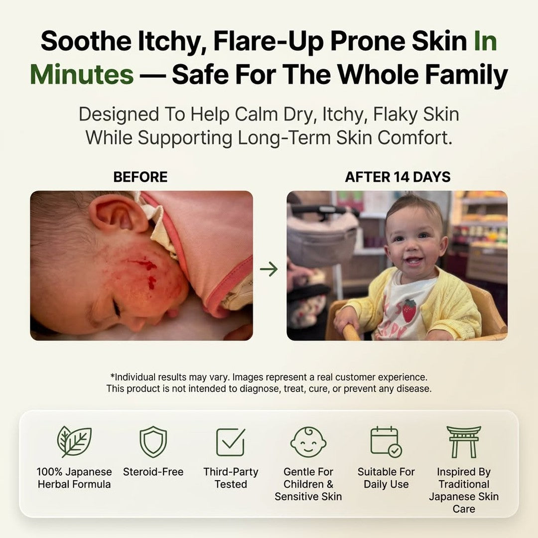 Herbal Psoriasis & Eczema Relief Skin Cream