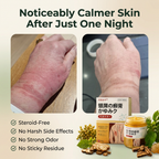 Herbal Psoriasis Relief Cream