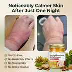Herbal Psoriasis Relief Cream application on dry itchy skin - steroid-free natural formula