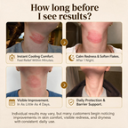 Herbal Psoriasis & Eczema Relief Skin Cream