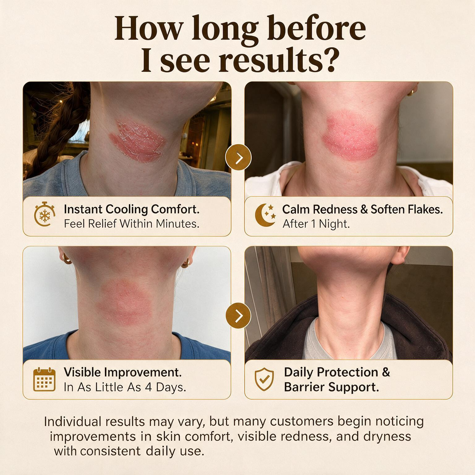 Herbal Psoriasis & Eczema Relief Skin Cream